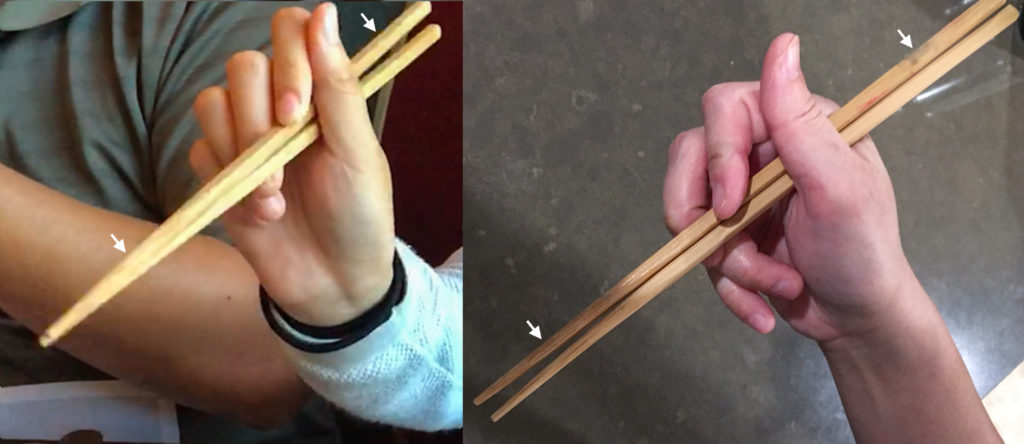 Chopsticks Marcosticks - User 12 mirrored-Scissorhand Grip-Compared to Chicken Claws grip-annotated-Closed posture-IMG_3436_mirrored_FRD