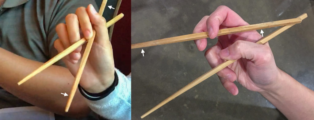 Chopsticks - User 12 mirrored-Scissorhand Grip-Compared to Chicken Claws grip-annotated-Open posture-IMG_3436_mirrored_FRD